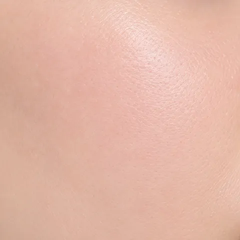 Close-up of normal skin